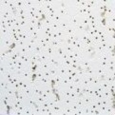 Armstrong Tatra 1 м?